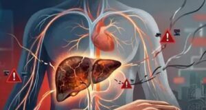 शरीर का ‘सिस्टम फेल’ कर सकती है लिवर की ये बीमारी