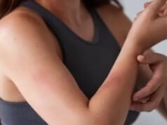 90% महिलाएं ही क्यों होती हैं Lupus का शिकार?