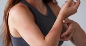 90% महिलाएं ही क्यों होती हैं Lupus का शिकार?