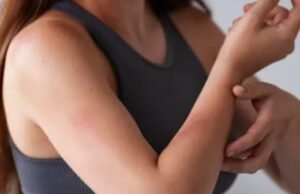 90% महिलाएं ही क्यों होती हैं Lupus का शिकार?