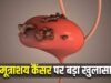 सर्जरी के बाद रेडिएशन थेरेपी से आधा हो जाता है Bladder Cancer का खतरा