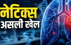 वैज्ञानिकों ने बताया कि क्यों नॉन-स्मोकर्स भी हो जाते हैं लंग कैंसर का शिकार