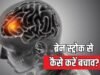 ‘मिनी स्ट्रोक’ को इग्नोर करना पड़ सकता है भारी!