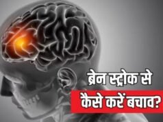 ‘मिनी स्ट्रोक’ को इग्नोर करना पड़ सकता है भारी!