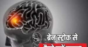 ‘मिनी स्ट्रोक’ को इग्नोर करना पड़ सकता है भारी!