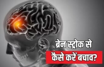 ‘मिनी स्ट्रोक’ को इग्नोर करना पड़ सकता है भारी!